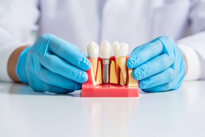 インプラントにメインテナンスは必要？その理由と正しいケア方法を解説