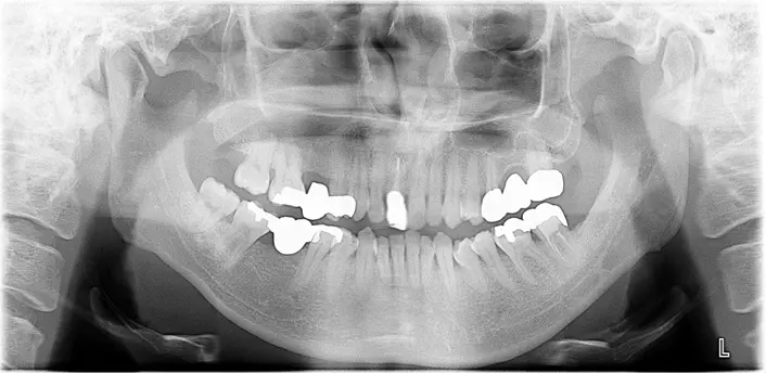 骨造成（サイナスリフト、GBR）、インプラント埋入、オールセラミッククラウン、セラミックインレー、ハイブリッドセラミック充填（ダイレクトボンディング）、ファイバーコア、ホワイトニング