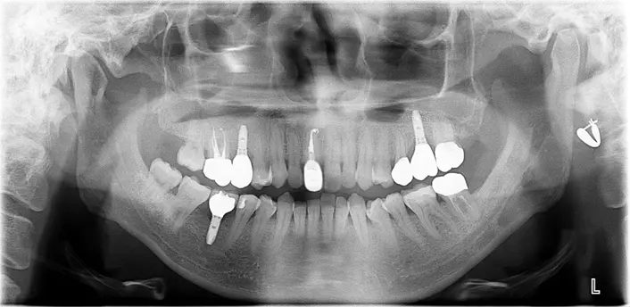 骨造成（サイナスリフト、GBR）、インプラント埋入、オールセラミッククラウン、セラミックインレー、ハイブリッドセラミック充填（ダイレクトボンディング）、ファイバーコア、ホワイトニング