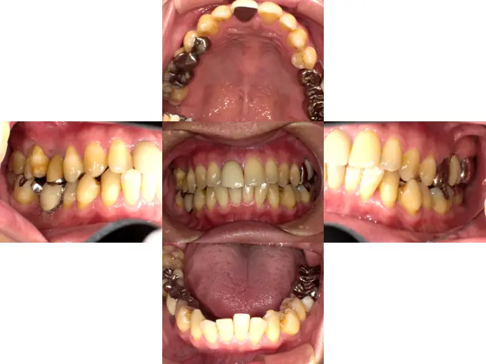 骨造成（サイナスリフト、GBR）、インプラント埋入、オールセラミッククラウン、セラミックインレー、ハイブリッドセラミック充填（ダイレクトボンディング）、ファイバーコア、ホワイトニング