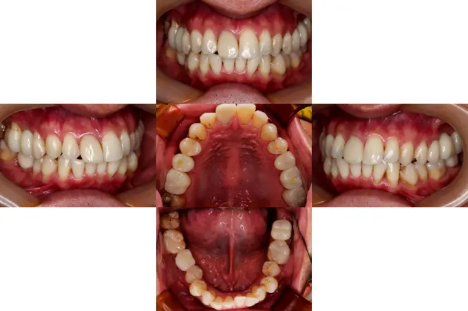 骨造成（サイナスリフト、GBR）、インプラント埋入、オールセラミッククラウン、セラミックインレー、ハイブリッドセラミック充填（ダイレクトボンディング）、ファイバーコア、ホワイトニング